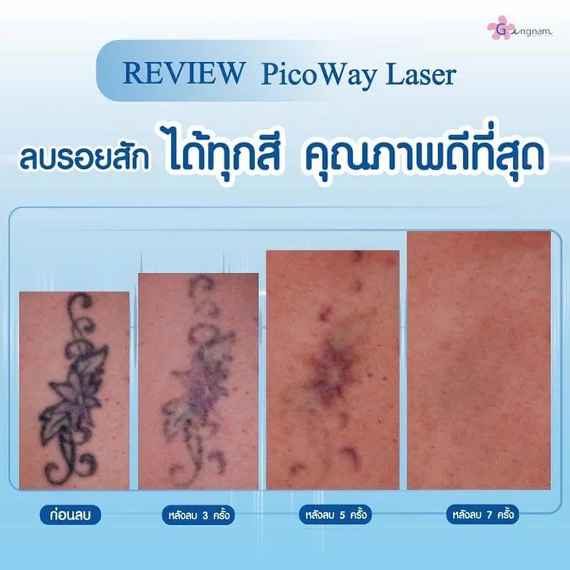 รีวิวลูกค้า 35