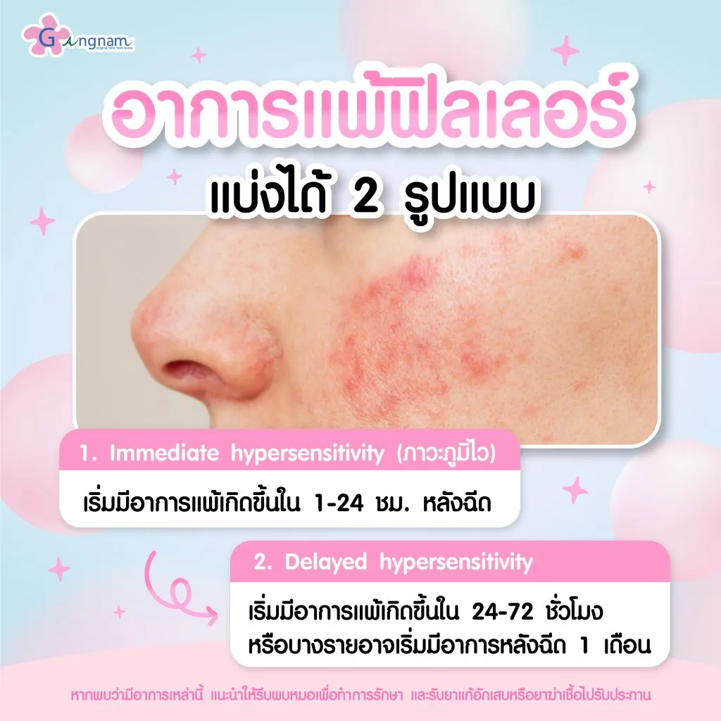 อาการแพ้ฟิลเลอร์