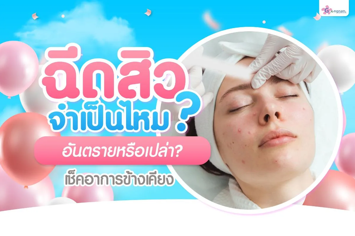 ฉีดสิวคืออะไร ปลอดภัยไหม เจ็บแค่ไหน กี่วันยุบ ไขทุกคำตอบที่ต้องรู้