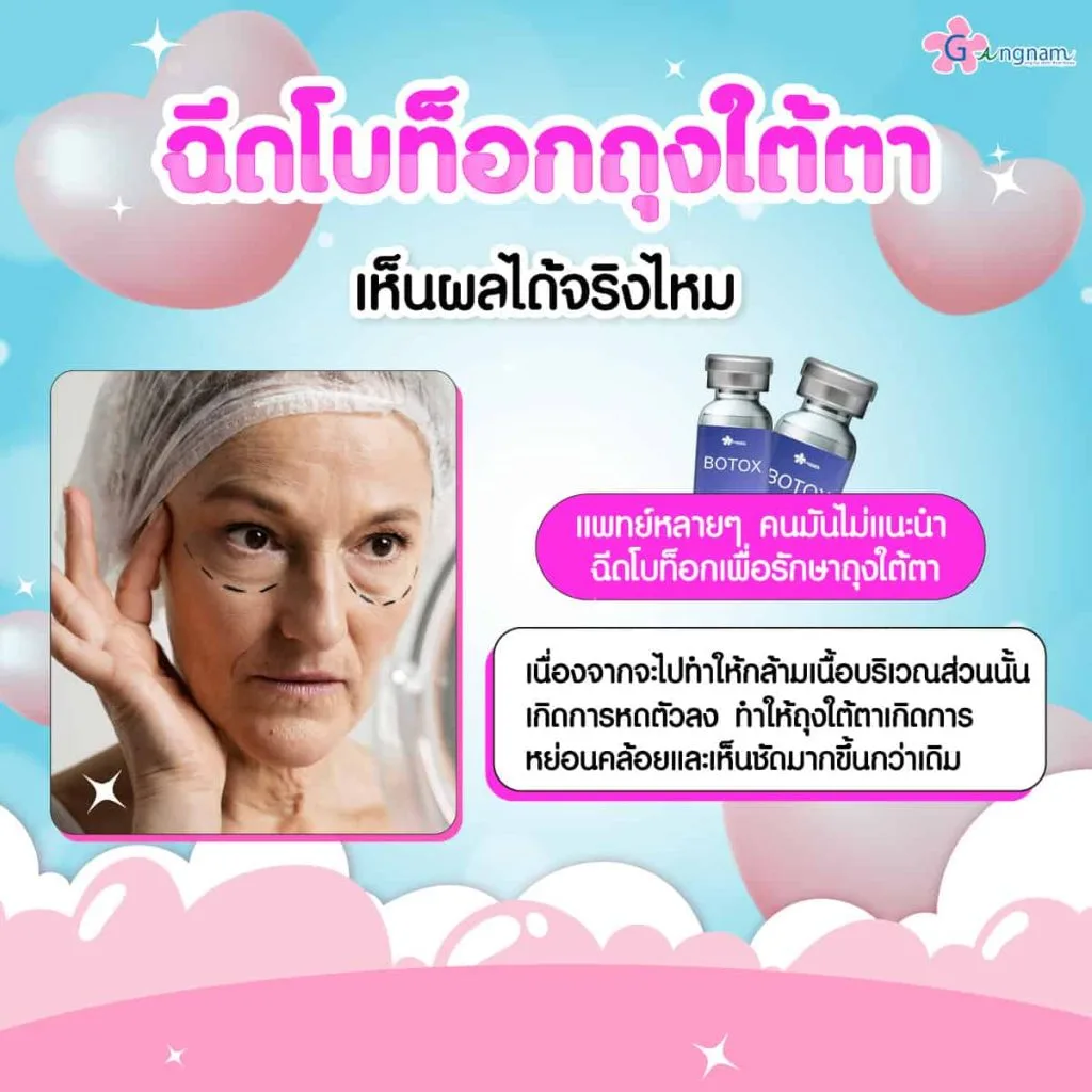 ฉีดโบท็อกถุงใต้ตาเห็นผลจริงไหม