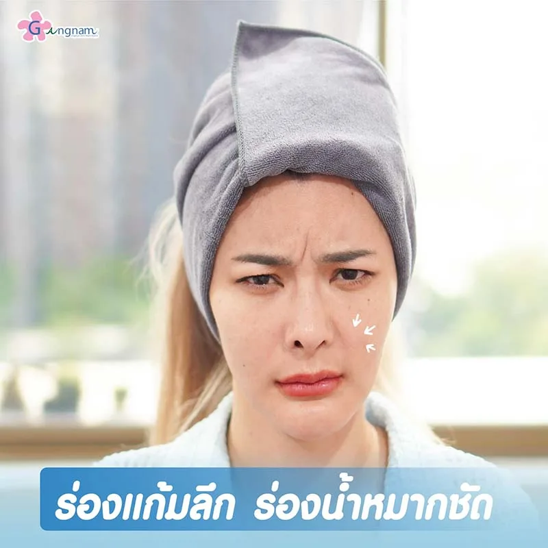 ปัญหาร่องแก้มลึก