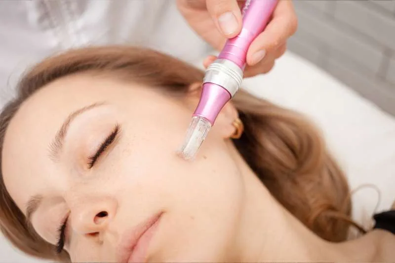 Microneedling แก้หลุมสิว