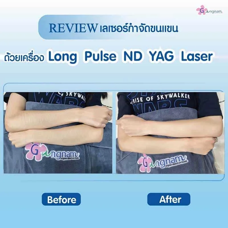 รีวิวลูกค้า 22