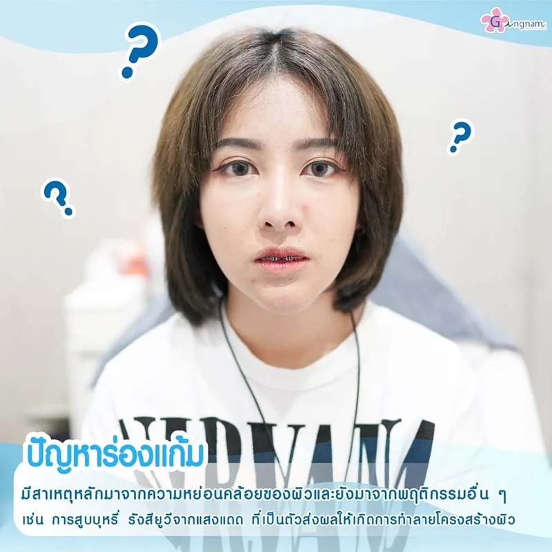 สาเหตุริ้วรอยร่องแก้ม